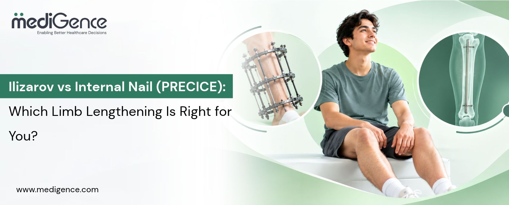Ilizarov vs Internal Nail (PRECICE): Which Limb Lengthening Is Right for You?